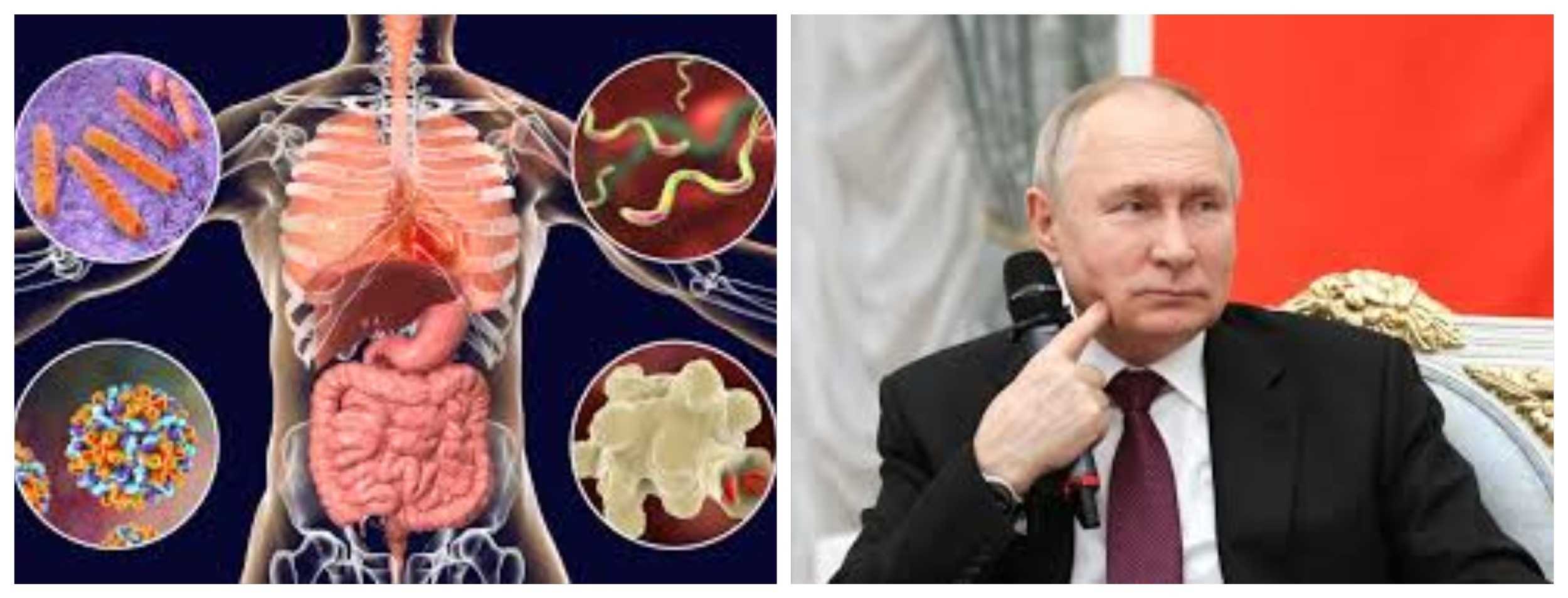 Scopri di più sull'articolo LA RUSSIA HA TROVATO IL VACCINO CONTRO IL CANCRO